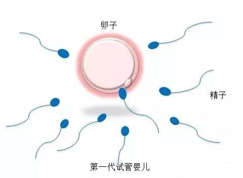 卵巢评估
